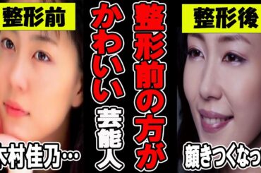 【がるちゃん芸能人】衝撃！整形前のほうが可愛い芸能人