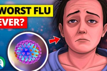 Why is the Flu Worse in 2025?