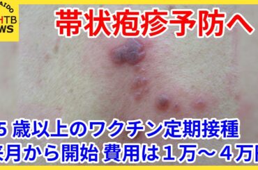 80歳までに3人に1人　帯状疱疹予防へ！65歳以上のワクチン定期接種、来月から開始　接種費用は約1万～4万円