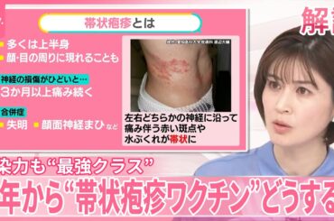 【帯状疱疹】日本人の90％にウイルスが──感染力も“最強クラス”  ワクチン定期接種…どうする？【#みんなのギモン】