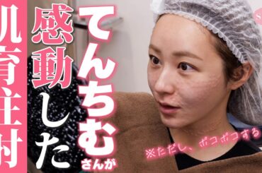 【毛穴レスツヤ美肌を作る】進化した女優注射に驚きを隠せないてんちむさん【ニキビ跡克服】湘南美容クリニック西川麗華医師