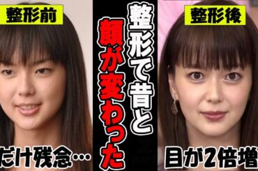 【がるちゃん芸能人】整形で昔と顔が変わった芸能人　衝撃のビフォーアフター！