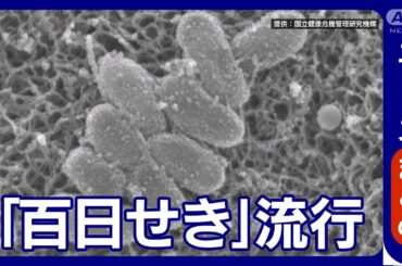 【百日せき】感染者が過去最多「誰も予想できず」薬不足 ワクチン効果10年で大人も注意【ニュースまとめ】ANN/テレ朝