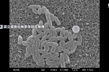 患者数は3週連続で過去最多「小さい子どもは症状が非常に強くなる」“百日ぜき”の流行止まらず  対策は…ワクチン、早期受診、マスク=静岡