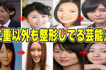 【雑談スレ】二重以外の整形をしている芸能人【ガルちゃん芸能人】