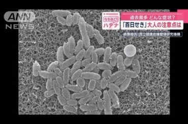 「百日せき」過去最多　大人の注意点は？【スーパーJチャンネル】(2025年5月7日)