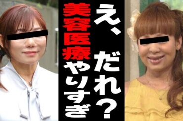 【有益2ch】やりすぎだろwwwww原型留めてない、美容医療の闇【ガルちゃん】