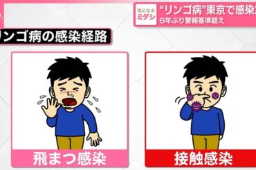 【“リンゴ病”】東京で感染急増  6年ぶり警報基準超え