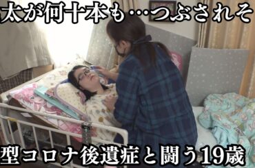 【シリーズ「終わらないコロナ」前編】「丸太が何十本も…つぶされそう」新型コロナ後遺症と闘う19歳