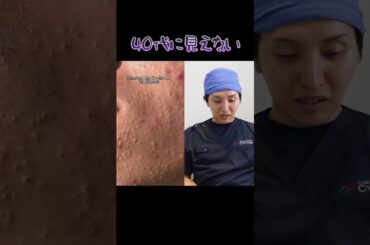 海外で話題のスキンケア…本当に美肌になれた？　#shorts #角栓 #毛穴