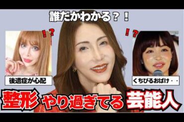 【ガルちゃん芸能】マジで整形やり過ぎてる！と思う芸能人