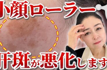 【肝斑改善】厄介な肝斑を消すスキンケアを美肌のプロが解説！小顔ローラーはまじで要注意です