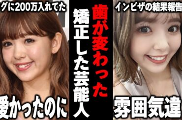 【ガルちゃん芸能】この人もセラミック…！？いつのまにか歯が変わっていた芸能人まとめ！