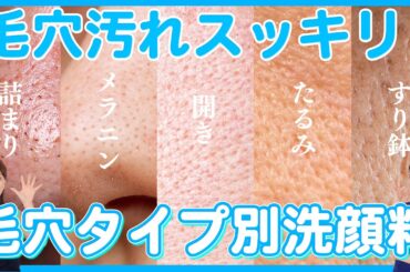 【毛穴5タイプ診断】あなたの毛穴にはコレ‼️プロが本気で選んだ洗顔料✨