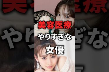 美容医療やりすぎな芸能人！