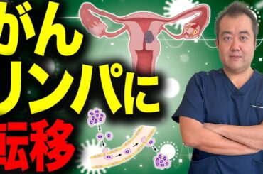 【婦人科がん】手術後に転移・再発が起きたら?婦人科医が治療と経過を徹底解説