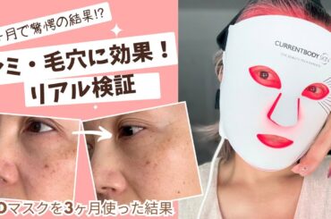 ［衝撃ビフォーアフター］LEDマスク3ヶ月目の変化とは⁉︎｜シミ・毛穴への効果をリアルに検証！