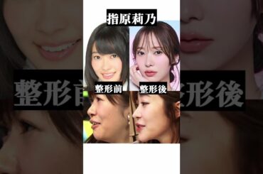 整形バレバレな元AKBメンバー#整形 #akb48 #二重整形