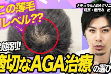 【治療別】AGA治療の効果はいつから出るの？医師が徹底解説！