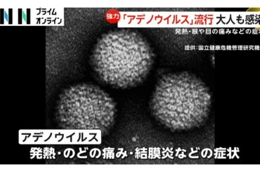 百日ぜき以外も…”アデノウイルス”流行で大人も感染「日常生活もきつい」発熱や結膜炎などの症状