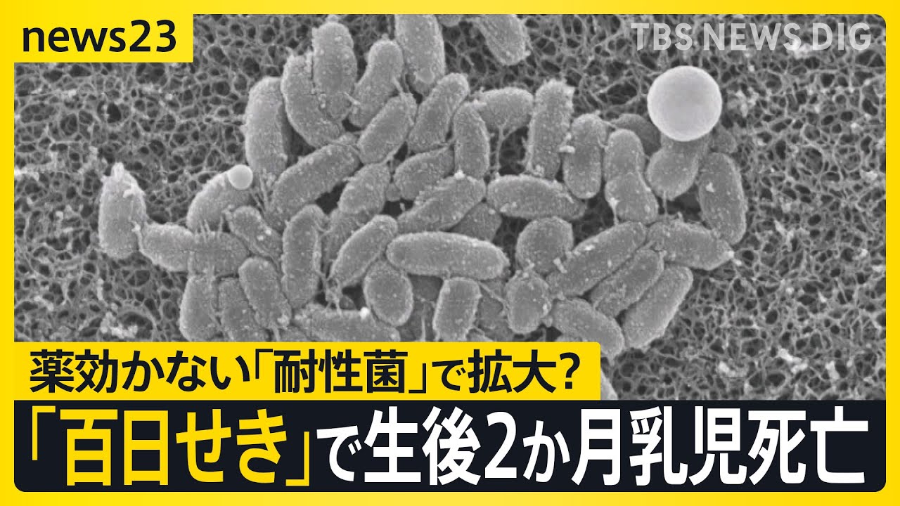 「百日せき」3週連続で患者数過去最多 生後2か月の乳児が死亡 薬が効かない「耐性菌」で感染拡大か【news23】|TBS NEWS DIG 「百日せき」3週連続で患者数過去最多 生後2か月の乳児が死亡 薬が効かない「耐性菌」で感染拡大か【news23】|TBS NEWS DIG