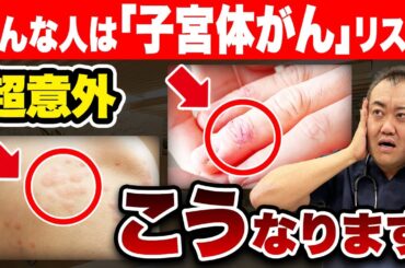 【放置危険】この皮膚のブツブツ『子宮体がん』のサインかもしれません。