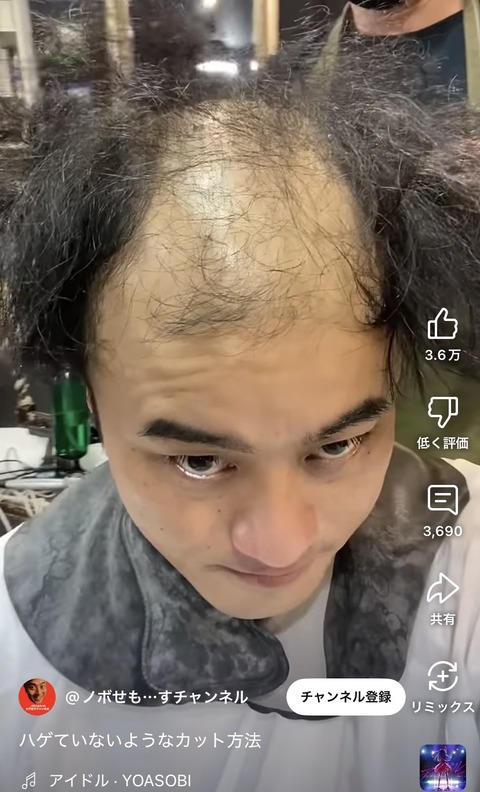【画像】カリスマ美容師、ハゲを救済してしまうwwwwwwwwwww