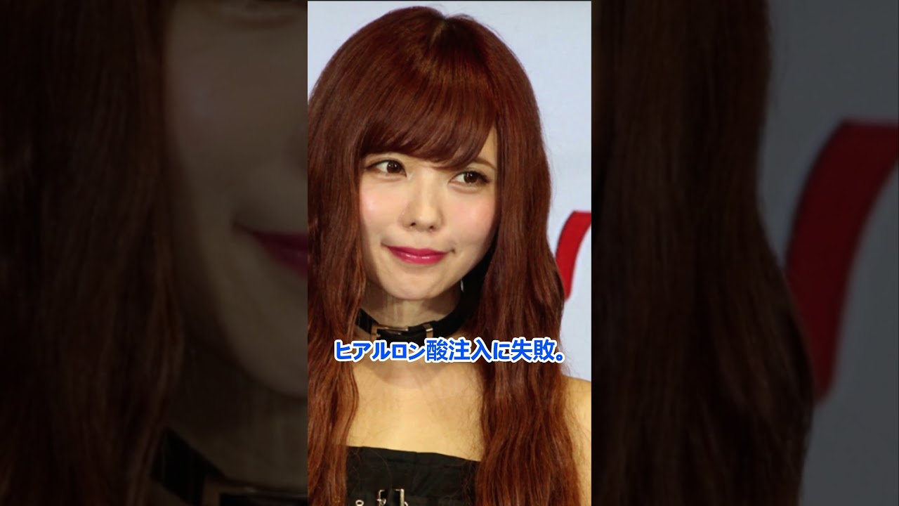 めちゃくちゃ可愛かったのに整形失敗した女性芸能人トップ4 #芸能人 #芸能 #雑学 #ランキング #板野友美 #益若つばさ #浜崎あゆみ #神田うの めちゃくちゃ可愛かったのに整形失敗した女性芸能人トップ4 #芸能人 #芸能 #雑学 #ランキング #板野友美 #益若つばさ #浜崎あゆみ #神田うの