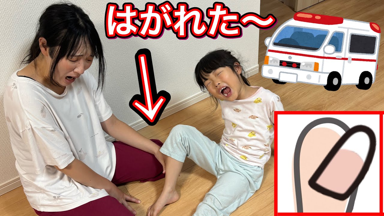 救急車呼んで〜爪はがれて大変〜ここちゃん突然泣き出してまさかの………😭【実話再現】 救急車呼んで〜爪はがれて大変〜ここちゃん突然泣き出してまさかの………😭【実話再現】