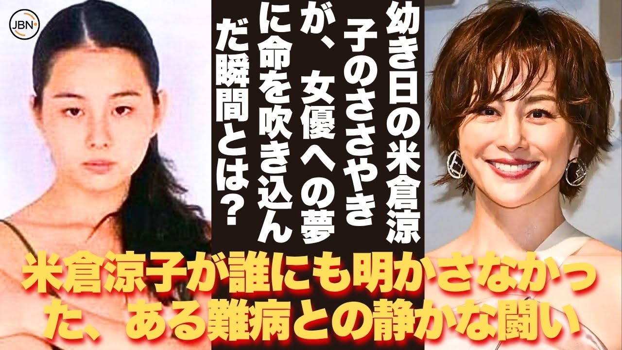 【懐かしい】ウソでしょ…同じ人なの!?米倉涼子さんのお顔に変化? 鼻や目元に注目集まる中、過去と現在を振り返る – 芸能人 昔と今 【米倉涼子】#懐かしい #芸能人 【懐かしい】ウソでしょ…同じ人なの!?米倉涼子さんのお顔に変化? 鼻や目元に注目集まる中、過去と現在を振り返る - 芸能人 昔と今 【米倉涼子】#懐かしい #芸能人