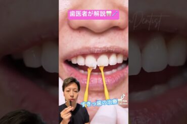 [感動]歯を削らないべニア治療（すきっ歯が治る）#ミニッシュ #ラミネートベニア #審美治療 #てんちむ