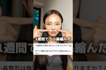 1週間で小鼻これ。ガチなビフォアフ。#小鼻縮小 #小鼻 #美容
