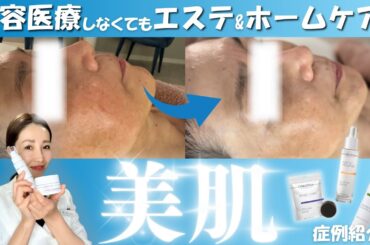 【エステだけで美肌】美容医療しなくても綺麗になれる!症例紹介【クリスティーナ】