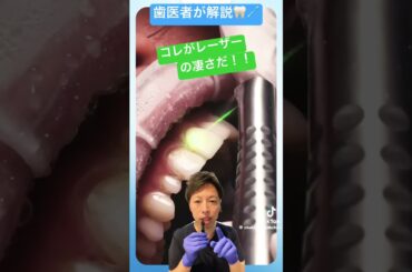 セラミック冠をレーザーで外す🦷#ラミネートベニア #ミニッシュ #てんちむ #美容 #仮歯