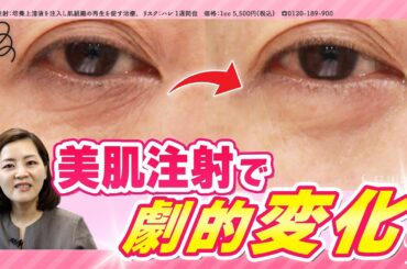 【シワ撃退】リジュランと同じ肌育治療 “ 美肌注射 ”の実力！#品川美容外科 #品川スキンクリニック