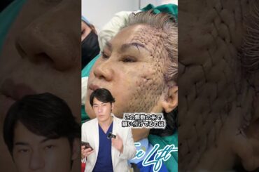 整形失敗...? やばいフェイスリフト #shorts