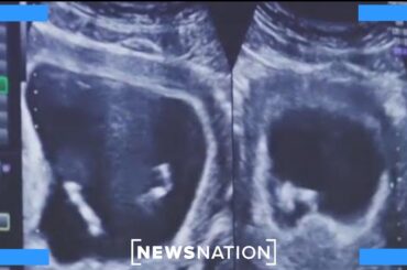 Mississippi declares public health emergency on infant mortality | Morning in America