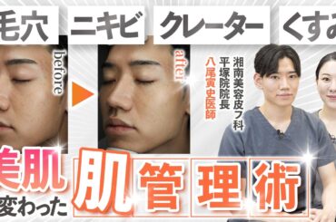 【美肌】肌質改善のプロが解説！本気の肌管理とは？