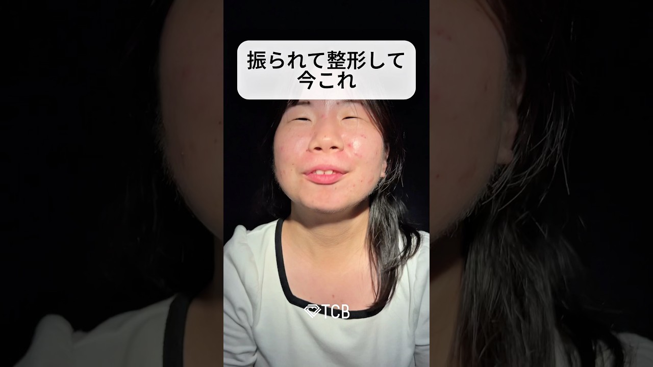 【二重整形】振られて整形して今これ#shorts 【二重整形】振られて整形して今これ#shorts