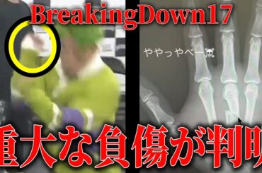BD17出場選手たちの怪我がヤバい…骨折選手が続出し、試合中止のカードまで出てきてしまう…【BreakingDown17オーディション】【ブレイキングダウン17】