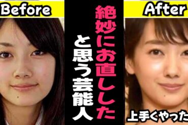 【ガルちゃん芸能】絶妙にお直ししたと思う芸能人まとめ【有益】