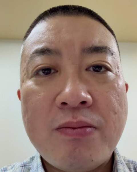 チョコプラ松尾さん、CM全降板祭りへｗｗｗｗｗｗｗｗｗｗｗｗｗｗｗｗｗｗｗｗｗｗｗ