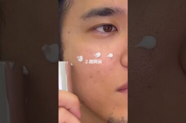 最強の導入美容液見つけた..#メンズ美容 #美肌 #毛穴の黒ずみ #イケメンになりたい #pr