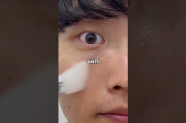 オールインだからガチで使いやすい！1本で済ませれるから使ってみて！#メンズ美容 #毛穴改善 #美肌 #おすすめ #pr