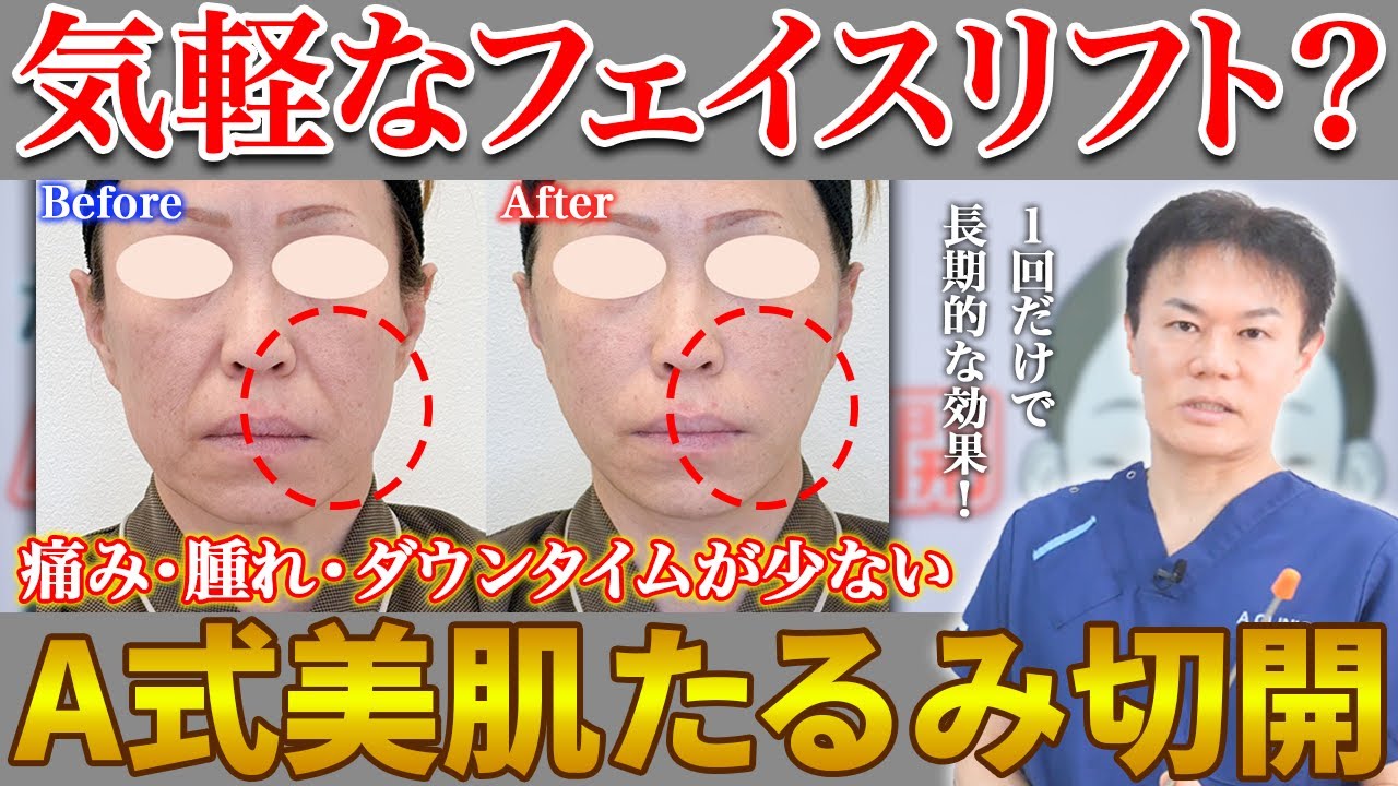 気軽に受けられるフェイスリフト?たるみを引き上げる”A式美肌たるみ切開”について解説 気軽に受けられるフェイスリフト?たるみを引き上げる"A式美肌たるみ切開"について解説