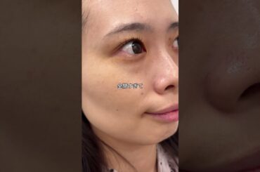 ガン黒毛穴ちゃんから卒業しました❣️❣️可愛くなりたい人は絶対使ってみてね！#毛穴ケア #垢抜け #美容 #コスメ紹介 #美肌 #美容液 #pr