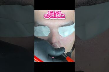 本気で毛穴を消したい人必見！✨ つるつる美肌になる毛穴洗浄を公開• #毛穴ケア• #毛穴洗浄• #黒ずみ解消• #角栓除去• #いちご鼻