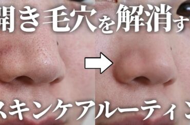 【毛穴に悩む30代必見】開き毛穴を解消して−5歳肌になれる✨スキンケアルーティン【案件なし】