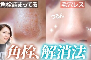 角栓を”終わらせる”3ステップを、2万人肌変えたプロが伝授