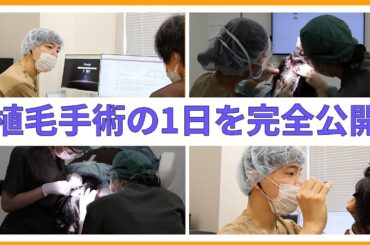 【大公開】見逃し厳禁!植毛手術の1日の流れをお見せします! 【大公開】見逃し厳禁!植毛手術の1日の流れをお見せします!